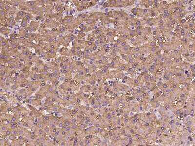 Immunohistochemistry-Paraffin: FBPase 1 Antibody [NBP2-97978] - Immunochemical staining of human FBPase 1 in human liver with rabbit polyclonal antibody at 1:100 dilution, formalin-fixed paraffin embedded sections.