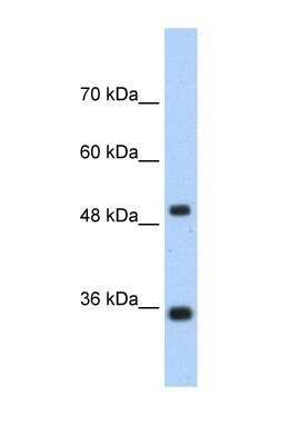 Western Blot: FBPase 1 Antibody [NBP1-55293] - Jurkat tissue lysate at a concentration of 1.25ug/ml.