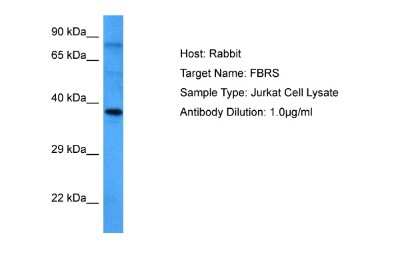 Western Blot: FBRS Antibody [NBP2-82760] - Host: Rabbit. Target Name: FBRS. Sample Tissue: Human Jurkat Whole Cell lysates. Antibody Dilution: 1ug/ml