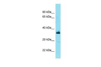 Western Blot: FBXL15 Antibody [NBP3-09719] - Western blot analysis of FBXL15 in Fetal Lung lysates. Antibody dilution at 1.0ug/ml