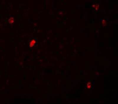 Immunocytochemistry/Immunofluorescence: FBXL16 Antibody [NBP1-76527] - Immunofluorescence of FBXL16 in human spleen tissue with FBXL16 antibody at 20 ug/mL.