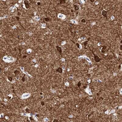 Immunohistochemistry-Paraffin: FBXL16 Antibody [NBP1-88440] - Staining of human caudate nucleus shows strong cytoplasmic positivity in neurons.
