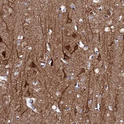 Immunohistochemistry-Paraffin: FBXL16 Antibody [NBP1-88440] - Staining of human cerebral cortex shows strong cytoplasmic positivity in neurons.