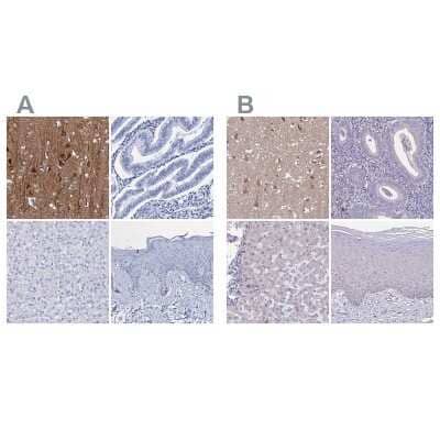 <b>Independent Antibodies Validation. </b>Immunohistochemistry-Paraffin: FBXL16 Antibody [NBP1-88440] - Staining of human cerebral cortex, endometrium, liver and skin using Anti-FBXL16 antibody NBP1-88440 (A) shows similar protein distribution across tissues to independent antibody NBP2-38789 (B).