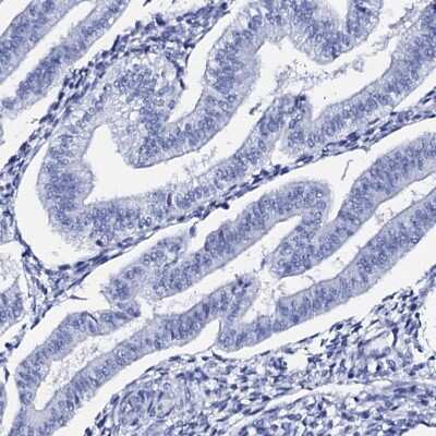<b>Orthogonal Strategies Validation. </b>Immunohistochemistry-Paraffin: FBXL16 Antibody [NBP1-88440] - Staining of human endometrium shows no positivity in glandular cells as expected.