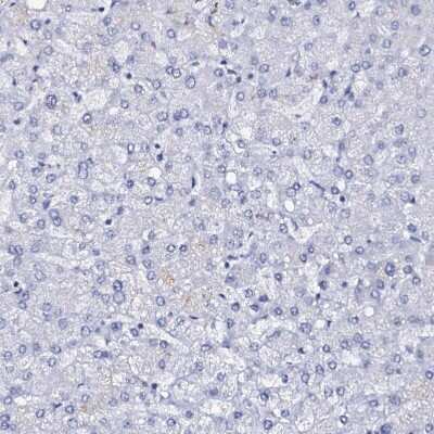 Immunohistochemistry-Paraffin: FBXL16 Antibody [NBP1-88440] - Staining of human liver shows no positivity in hepatocytes as expected.
