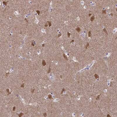 Immunohistochemistry-Paraffin: FBXL16 Antibody [NBP2-38789] - Staining of human caudate nucleus shows strong cytoplasmic positivity in neurons.
