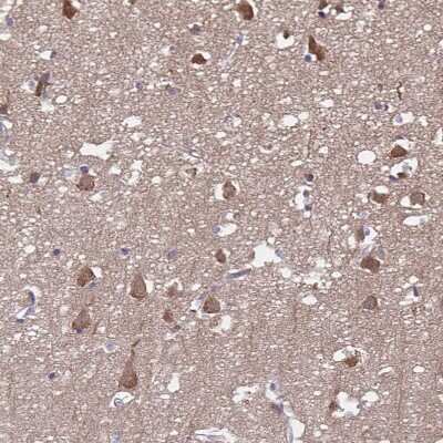 Immunohistochemistry-Paraffin: FBXL16 Antibody [NBP2-38789] - Staining of human cerebral cortex shows moderate cytoplasmic positivity in neurons.