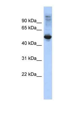 Western Blot: FBXL16 Antibody [NBP1-57613] - Hela cell lysate, concentration 0.2-1 ug/ml.