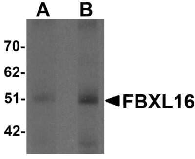 Western Blot: FBXL16 Antibody [NBP1-76527] - Human spleen tissue lysate with FBXL16 antibody at (A) 0.5 and (B) 1 ug/mL.