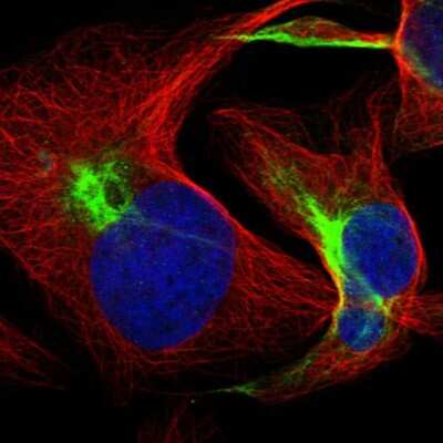 Immunocytochemistry/Immunofluorescence: FBXL19 Antibody [NBP2-55533] - Staining of human cell line U-2 OS shows localization to intermediate filaments.
