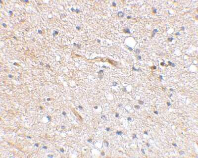 Immunohistochemistry-Paraffin FBXL20 Antibody - BSA Free