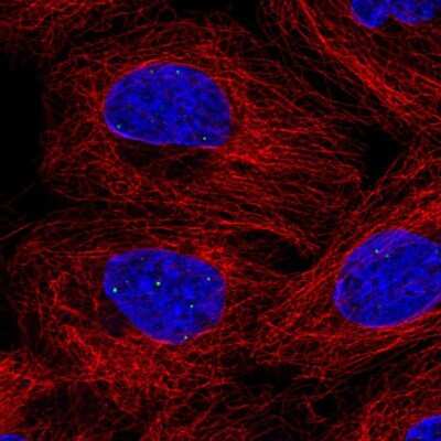 Immunocytochemistry/Immunofluorescence: FBXL3 Antibody [NBP2-56645] - Staining of human cell line A-431 shows localization to nuclear bodies.