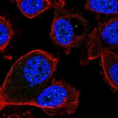 Immunocytochemistry/Immunofluorescence: FBXL3 Antibody [NBP2-58640] - Staining of human cell line PC-3 shows localization to nuclear bodies.