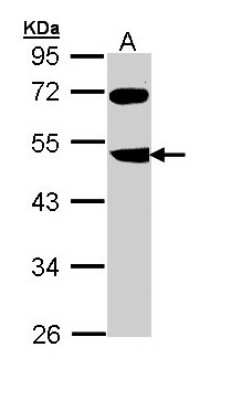Western Blot: FBXL3 Antibody [NBP1-32979] - Sample (30 ug of whole cell lysate) A: Molt-4 10% SDS PAGE; antibody diluted at 1:1000.