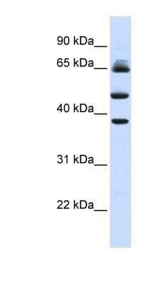 Western Blot: FBXL3 Antibody [NBP1-53021] - Human Liver cell lysate, concentration 0.2-1 ug/ml.