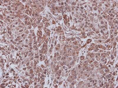 Immunohistochemistry-Paraffin: FBXL4 Antibody [NBP2-16440] - A547 xenograft, using FBL4 antibody at 1:500 dilution. Antigen Retrieval: Trilogy™ (EDTA based, pH 8.0) buffer, 15min.