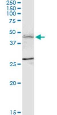 Western Blot: FBXL7 Antibody (2G10) [H00023194-M01] - FBXL7 monoclonal antibody (M01), clone 2G10. Analysis of FBXL7 expression in MCF-7.
