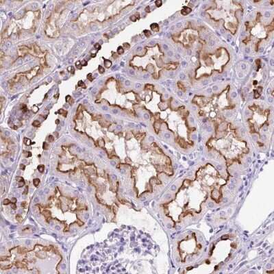Immunohistochemistry: FBXL7 Antibody [NBP2-49184] - Staining of human kidney shows strong cytoplasmic and membranous positivity in cells in tubules.