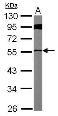 Western Blot: FBXL7 Antibody [NBP2-16443] - Sample (50 ug of whole cell lysate) A: Mouse Heart, 10% SDS PAGE gel, diluted at 1:1000.