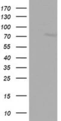 Western Blot: FBXO11 Antibody (1F6) [NBP2-45620] - Analysis of HEK293T cells were transfected with the pCMV6-ENTRY control (Left lane) or pCMV6-ENTRY FBXO11.