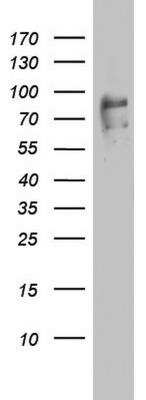 Western Blot: FBXO11 Antibody (1F6) [NBP2-45620] - Analysis of HT29 cell lysate (35ug).