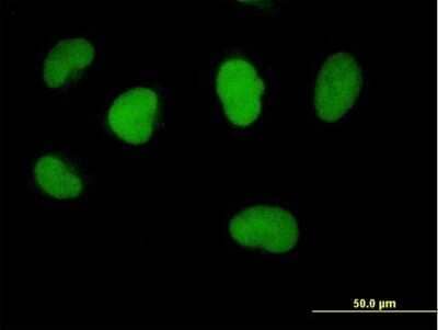 Immunocytochemistry/Immunofluorescence: FBXO11 Antibody [H00080204-B01P] - Analysis of purified antibody to FBXO11 on HeLa cell. (antibody concentration 10 ug/ml)