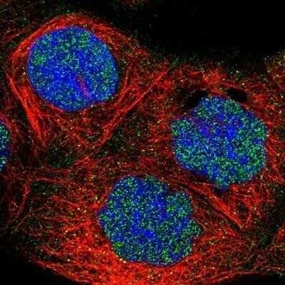 Immunocytochemistry/Immunofluorescence: FBXO11 Antibody [NBP1-84712] - Staining of human cell line A-431 shows positivity in nucleus and nucleoli. Antibody staining is shown in green.