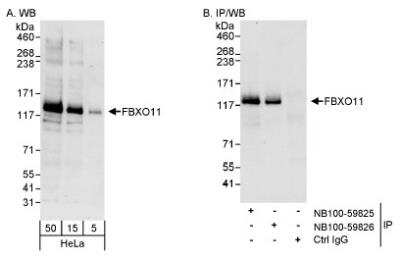 Western Blot FBXO11 Antibody