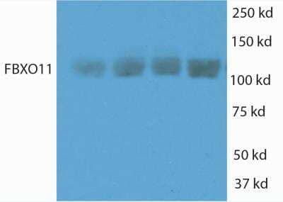 Western Blot FBXO11 Antibody