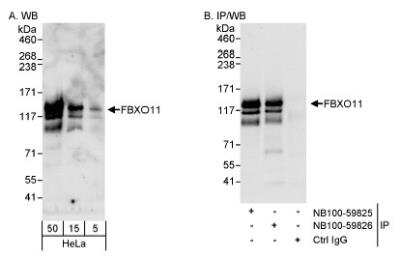 <b>Independent Antibodies Validation and Genetic Strategies Validation.</b>Western Blot: FBXO11 Antibody [NB100-59826] - Detection of Human FBXO11 on HeLa whole cell lysate using NB100-59826. FBXO11 was also immunoprecipitated by rabbit anti-FBXO11 antibody NB100-59825.
