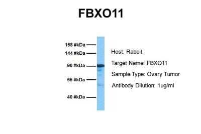 Western Blot: FBXO11 Antibody [NBP1-55066] - Sample Tissue: Human Ovary Tumor Antibody Dilution: 1.0 ug/ml