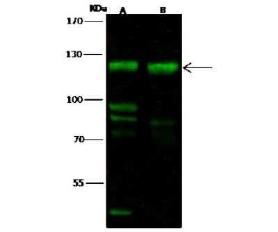 Western Blot: FBXO11 Antibody [NBP2-98996] - Anti-FBXO11 rabbit polyclonal antibody at 1:500 dilution. Lane A: 293T Whole Cell Lysate. Lane B: HeLa Whole Cell Lysate. Lysates/proteins at 30 ug per lane. Secondary Goat Anti- Rabbit IgG H&L (Dylight 800) at 1/10000 dilution. Developed using the Odyssey technique. Performed under reducing conditions. Predicted band size: 94 kDa. Observed band size: 120 kDa (We are unsure as to the identity of these extra bands).