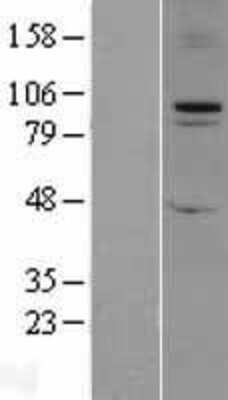 Western Blot FBXO11 Overexpression Lysate