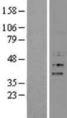 Western Blot: FBXO15 Overexpression Lysate (Adult Normal) [NBP2-05321] Left-Empty vector transfected control cell lysate (HEK293 cell lysate); Right -Over-expression Lysate for FBXO15.