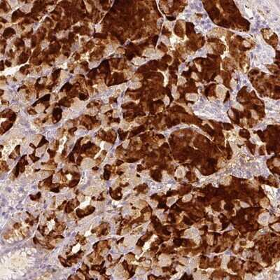 Immunohistochemistry: FBXO16 Antibody [NBP2-33700] - Staining of human stomach, upper shows strong cytoplasmic positivity in glandular cells.