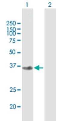 Western Blot FBXO2 Antibody