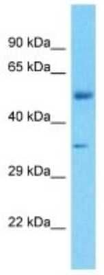 Western Blot: FBXO2 Antibody [NBP3-10565] - Western blot analysis of FBXO2 in Human Liver Tumor. Antibody dilution at 1ug/ml