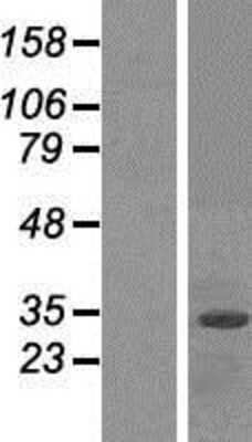 Western Blot FBXO2 Overexpression Lysate