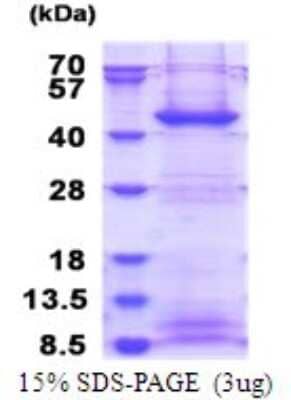 SDS-PAGE Recombinant Human FBXO2 His Protein