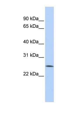 Western Blot: FBXO22 Antibody [NBP1-55425] - HepG2 cell lysate, concentration 0.2-1 ug/ml.