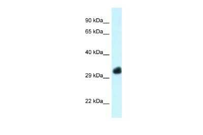 Western Blot: FBXO22 Antibody [NBP2-88818] - WB Suggested Anti-Fbxo22 Antibody. Titration: 1.0 ug/ml. Positive Control: Mouse Heart