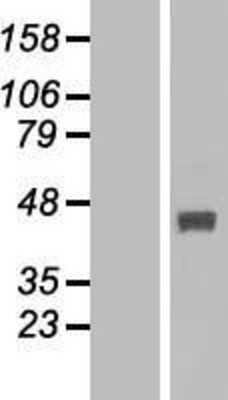 Western Blot: FBXO22 Overexpression Lysate (Adult Normal) [NBL1-10623] Left-Empty vector transfected control cell lysate (HEK293 cell lysate); Right -Over-expression Lysate for FBXO22.