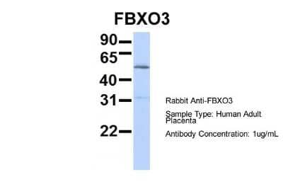 Western Blot: FBXO3 Antibody [NBP1-55046] - Sample Type: Human Adult Placenta Antibody Dilution: 1.0 ug/ml