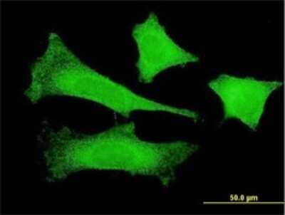 Immunocytochemistry/Immunofluorescence: FBXO4 Antibody (2F2) [H00026272-M02] - Analysis of monoclonal antibody to FBXO4 on HeLa cell . Antibody concentration 10 ug/ml.