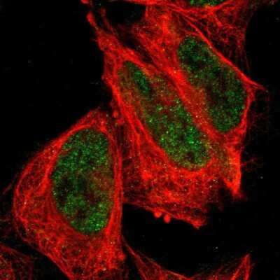 Immunocytochemistry/Immunofluorescence: FBXO4 Antibody [NBP2-58623] - Staining of human cell line U-2 OS shows localization to nucleus.