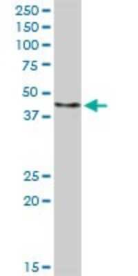 Western Blot: FBXO4 Antibody [H00026272-D01P] - Analysis of FBXO4 expression in human pancreas.