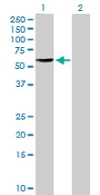 Western Blot: FBXO4 Antibody [H00026272-D01P] - Analysis of FBXO4 expression in transfected 293T cell line by FBXO4 polyclonal antibody.Lane 1: FBXO4 transfected lysate(44.10 KDa).Lane 2: Non-transfected lysate.