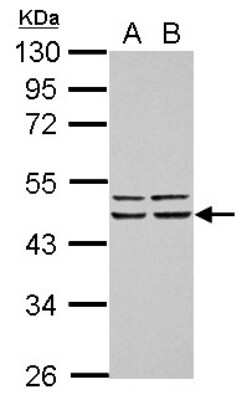 Western Blot FBXO4 Antibody - BSA Free