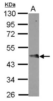 Western Blot FBXO4 Antibody